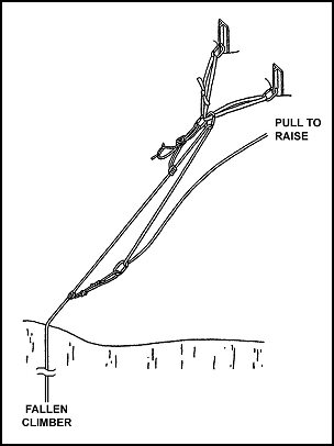 Figure 7-26. Z-pulley system.